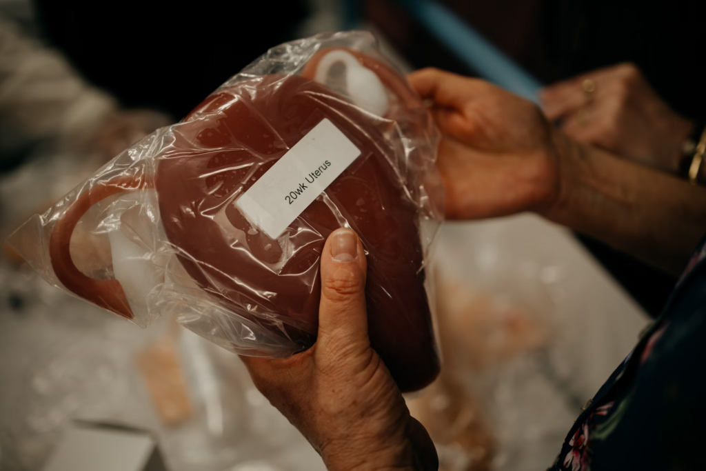 A model of a human uterus in a plastic bag